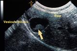 Echographie vétérinaire foie 